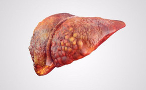 Không phải vàng da và ngứa, đây là 5 dấu hiệu ít ngờ tới 'tố cáo' gan cần được khám ngay