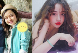 9X sở hữu gương mặt búp bê sau khi chi 100 triệu đồng 'dao kéo'