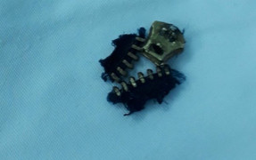 Ông bố nhập viện vì 'cậu nhỏ' bị kẹt vào khóa quần