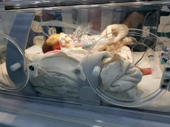 Hành trình 88 ngày kỳ diệu của bé tí hon 700g sinh non