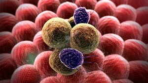 Dấu hiệu ung thư tuổi 50 đừng lơ đi kẻo chết sớm