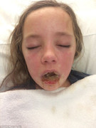 Dị ứng thuốc giảm đau, cô bé 10 tuổi tạo nên kỳ tích khi đánh thắng cả tử thần