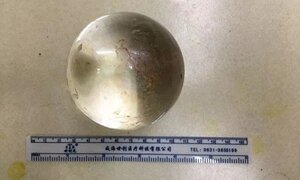 Người đàn ông đút quả bóng thủy tinh vào tận trực tràng và cái kết đắng