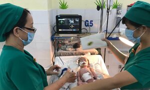 Xót lòng bé gái vừa chào đời ruột lòi ra ngoài ổ bụng