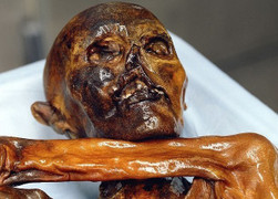 Xác ướp người băng bị nguyền rủa khi còn sống có thể bị bệnh tim