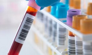 Khám phá mới giải thích vì sao không thể chữa khỏi HIV