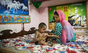 Đáng thương bé gái 2 tuổi mắc bệnh lạ, da mọc vẩy như thằn lằn