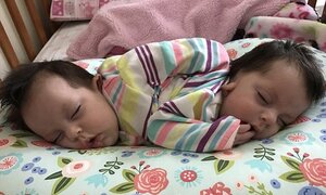 Chẩn đoán không thể sống quá 3 tháng, cặp song sinh dính liền vẫn khỏe mạnh