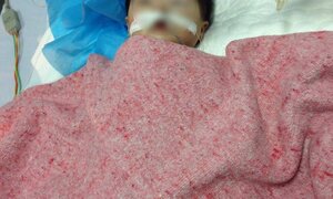 Sức khỏe bé 8 tháng tuổi ở Hà Nội bị nhầm đường dùng thuốc ra sao?