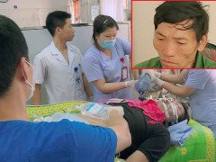 Bắt giữ tội phạm ma túy, một chiến sỹ công an bị tông xe dập phổi