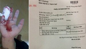 Rách tay, nam thanh niên được chỉ định khâu âm đạo: Sở Y tế Hà Nội chỉ đạo