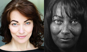 Bị ung thư da ác tính, nữ diễn viên tiết lộ nguyên nhân đáng sợ