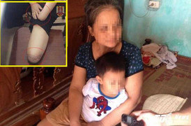 Người phụ nữ thuê người chặt tay chân: Công an vạch trần sự thật thế nào?