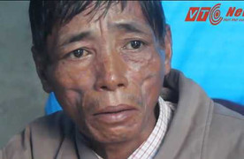 Những đứa trẻ bất hạnh ở gia đình bố xơ gan, mẹ chết không có tiền mua quan tài chôn cất