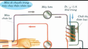 Chạy thận nhân tạo: Những tai biến rủi ro ai cũng phải biết