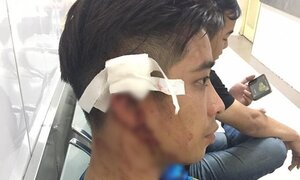 Đến phòng tập gym cùng bạn gái, bị nhân viên dùng bình cứu hỏa đánh vỡ đầu
