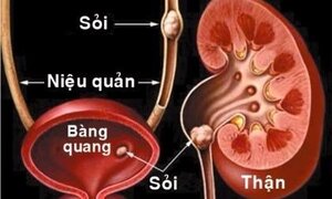 Video: Hai quả thận của bạn đã phải làm việc vất vả thế nào?