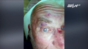 5 thanh niên hành hung du khách Hà Lan ở Sa Pa: Công an vào cuộc điều tra