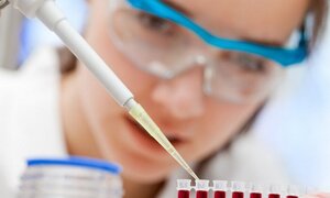 Ung thư máu - Những điều nên biết để phòng và điều trị hiệu quả