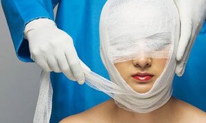 Nếu muốn phẫu thuật thẩm mỹ, bạn hãy lường trước 9 nguy cơ này
