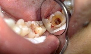 5 bộ phận vô dụng nhất trên cơ thể người