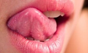 Bệnh lạ: Thấy vị ngọt trong miệng mỗi khi nghe tên sếp