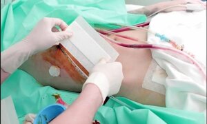 Khám phá bí mật cơ thể người khi thiếu mất 1 quả thận
