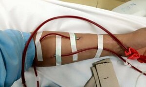 Kinh hoàng: 75% mẫu nước dùng cho chạy thận không đủ tiêu chuẩn