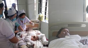 Đốt đèn dầu bắt muỗi, mẹ con bệnh nhi bỏng nặng nhập viện