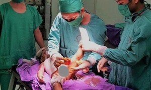 Bị nước sôi đổ vào người, bé trai 2 tuổi lột từng mảng da từ ngực đến chân
