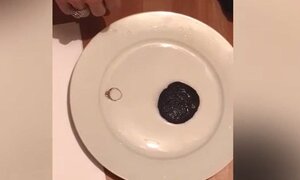 Video: Khối u được lấy ra từ cơ thể người bệnh có thể hút chiếc nhẫn vàng?