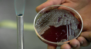 Phát hiện không ngờ trong cơ thể binh sỹ Triều Tiên đào tẩu