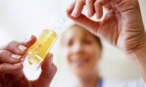 Xét nghiệm nước tiểu có thể dự đoán được cái chết