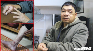 Bữa khoai vằm cuối cùng với mẹ của chiến sĩ Gạc Ma trước lúc hy sinh