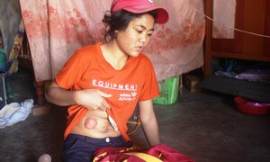 Tội nghiệp cô bé không có hậu môn đi chăn bò thuê kiếm sống