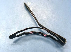 Bệnh nhi 12 tuổi thủng tá tràng vì nuốt phải chiếc kẹp tóc