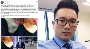 MC bị tố bạo hành, đánh đập em vợ suốt 5 năm có thể bị xử lý thế nào?