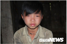 Những đứa trẻ bị 'giời hành' có hai 'của quý' ở Hà Giang: Đều mắc các bệnh thuộc nhóm bệnh hiếm