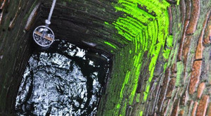 Chơi ở sân giếng mọc rêu xanh, bé gái 4 tuổi gãy 1/3 xương đùi trái