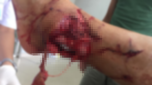 Nạn nhân ám ảnh bị chó cắn: Những con 'quái vật' vỏ bọc thân thiện nhà nuôi