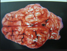 Quấy khóc không chịu ngủ, bé 2 tháng tuổi bị cha làm xuất huyết não