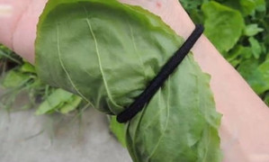 Tin thầy lang đắp lá thuốc chữa gãy tay, bệnh nhi 5 tuổi viêm tủy xương cấp