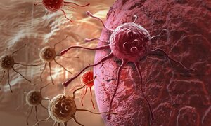 Tế bào ung thư di căn lây lan thế nào?