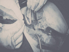 Nam thanh niên bị đâm thấu tim, sốc mất máu nặng được cứu