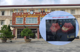 Thai bình thường nhưng bác sĩ chẩn đoán chết lưu ở Huế: Lãnh đạo Sở Y tế lên tiếng