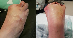 Spa cá rỉa: Liệu pháp làm đẹp 'chết người', coi chừng hoại tử, nhiễm HIV