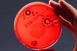 Dựng tóc gáy với những loại vi khuẩn lúc nhúc bám trên điện thoại của bạn