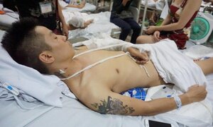 Nam thanh niên bị nhóm người bịt mặt chém nát chân ở Phú Thọ: Khởi tố vụ án