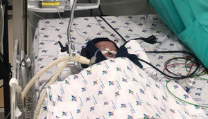 Dị dạng vòng nhẫn mạch máu hiếm gặp, bé trai 1.5 tháng tuổi suy hô hấp nặng