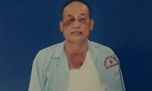 Bị đánh gãy xương vai còn bị công an phạt vi phạm hành chính